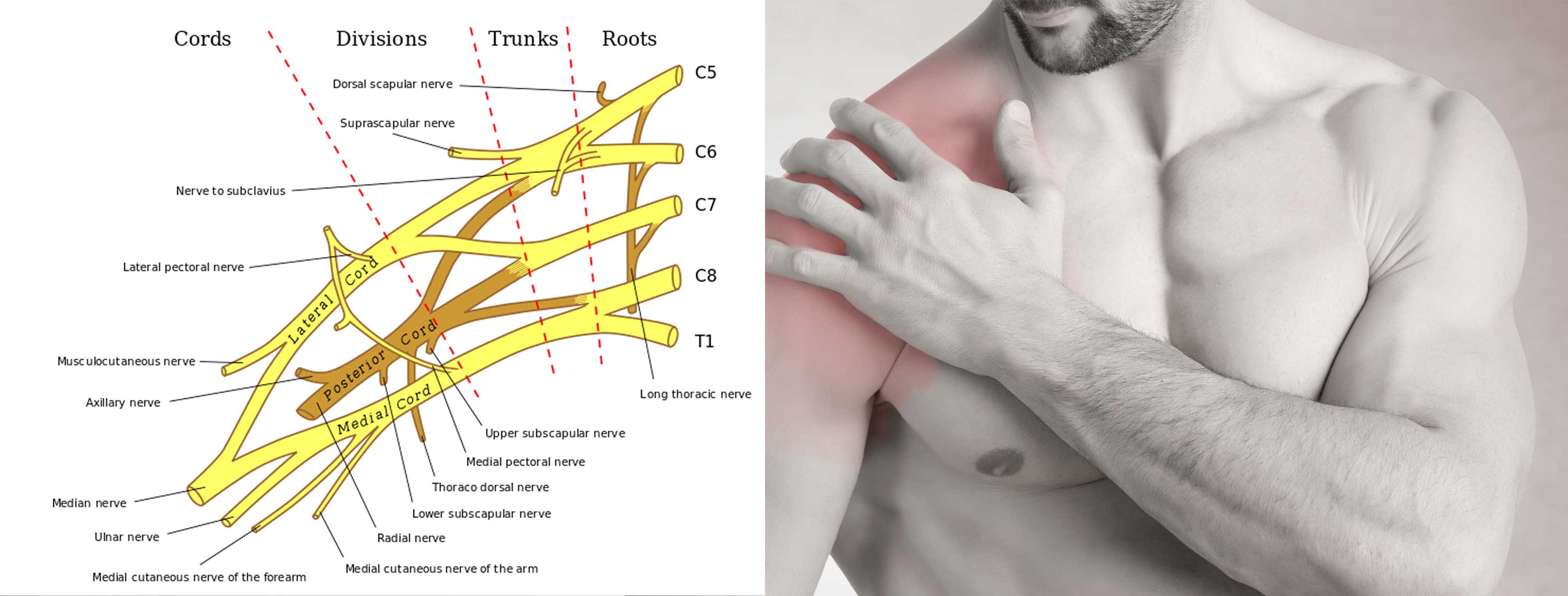 Shoulder pain