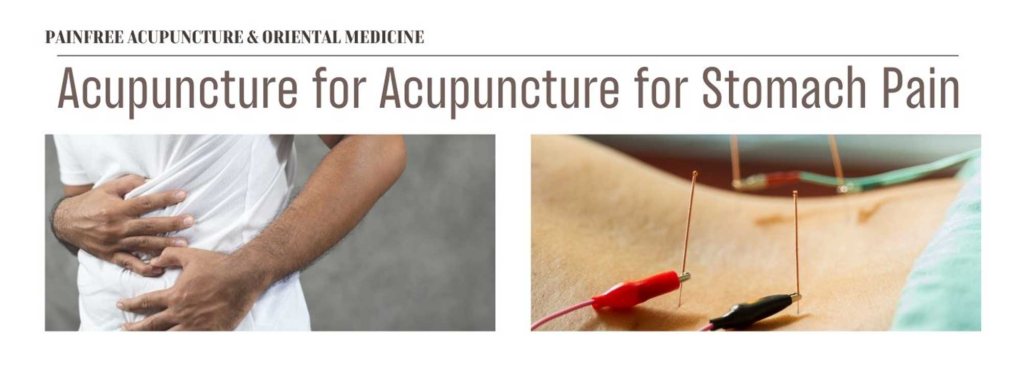 Acupuncture