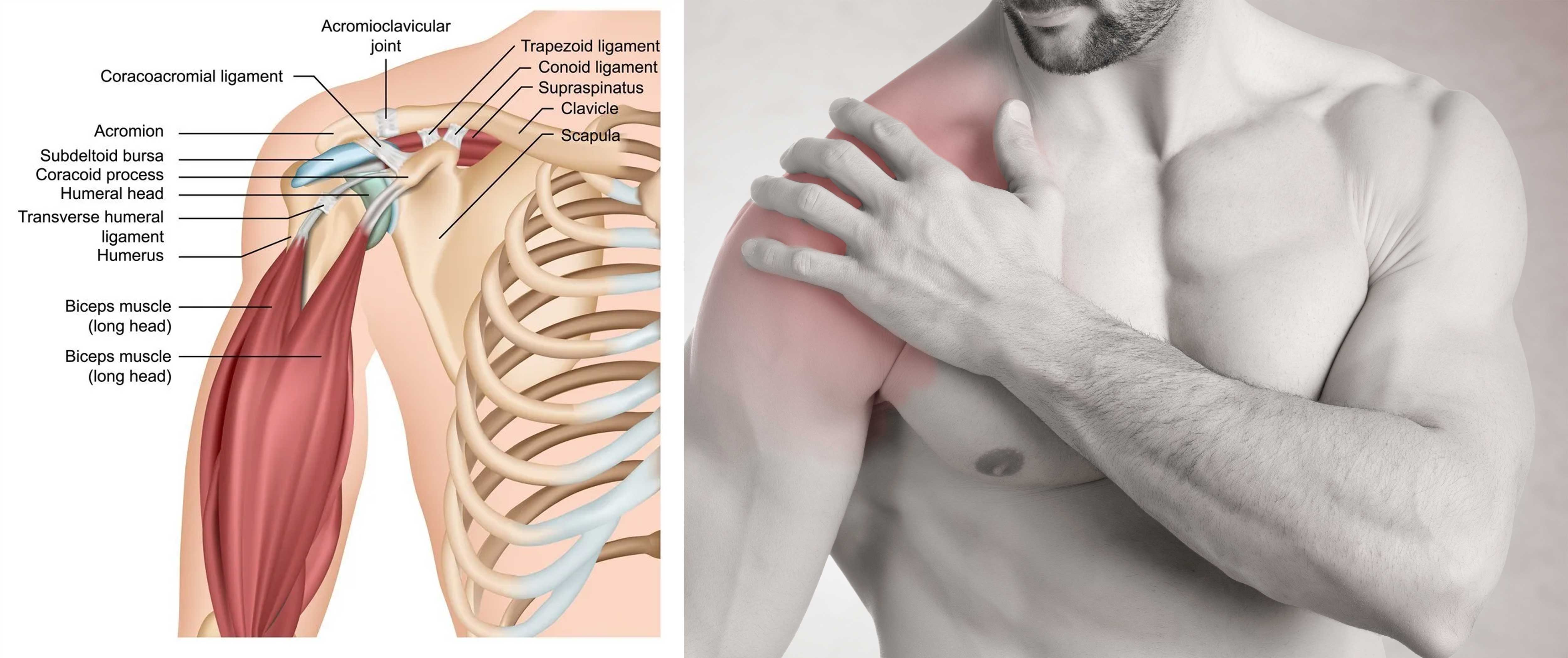 Shoulder pain